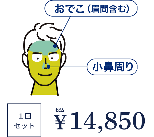 顔全部セット(鼻下/口下/もみあげ/両ほほ/あご/あご下・首/おでこ/小鼻周り)